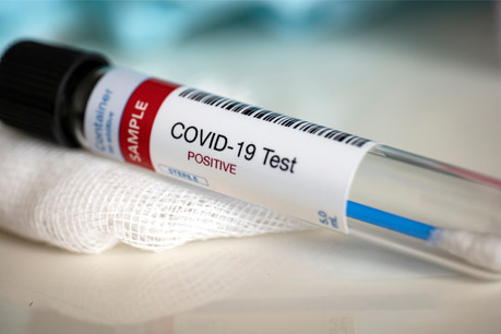 Plus de 6.000 tests ont été effectués sur la journée du mardi 6 octobre. (Photo: Shutterstock)
