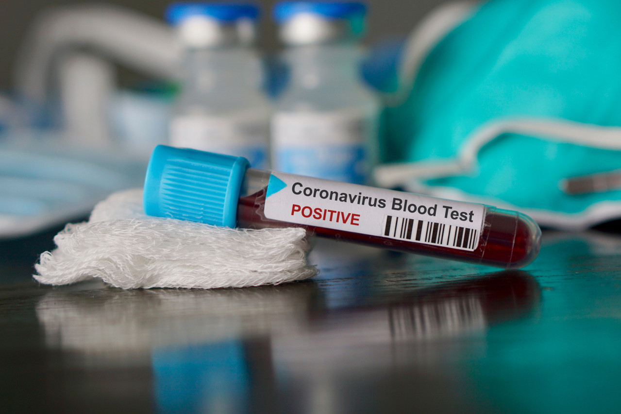 La personne suspectée d’être atteinte du coronavirus a pu rentrer chez elle, après des analyses du Laboratoire national de santé excluant tout risque. (Photo: Shutterstock)