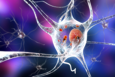 La méthodologie choisie au Luxembourg est avant-gardiste, mais OrganoTherapeutics, qui a déjà breveté une partie de son innovation, s’attend à une concurrence féroce dans le cadre de la lutte contre la maladie de Parkinson. (Photo: Shutterstock)