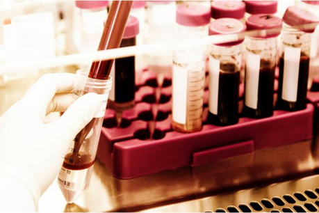 L'ISBER et l’IBBL a accueilli des experts en recherche préanalytique au Luxembourg pour le tout premier Symposium « Biospecimen Research » en Europe! (Photo: © IBBL/ISBER)