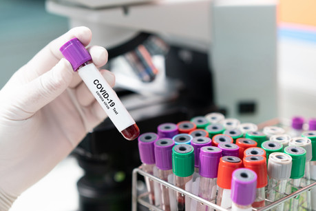 8.863 tests ont été menés mardi. (Photo: Shutterstock)