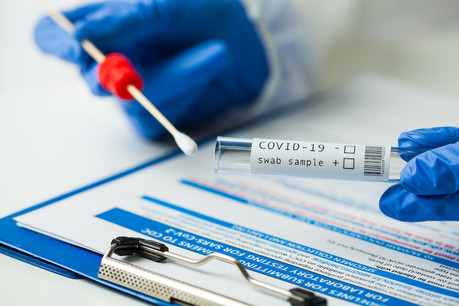 44 contaminations ont eu lieu en 24 heures sur les 7.812 tests effectués, selon le dernier bilan du ministère de la Santé. (Photo: Shutterstock)