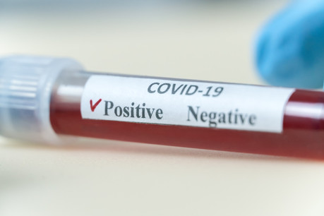 Le chiffre des cas positifs a baissé samedi, en comparaison avec vendredi lorsqu’un record d’infections dépistées avait été établi. (Photo: Shutterstock)