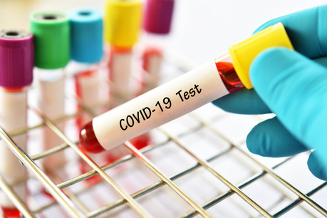 Plus de 22.000 tests ont été réalisés sur les journées de vendredi et samedi. (Photo: Shutterstock)