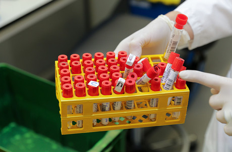 Le Luxembourg compte 8.595 tests positifs depuis le début de la crise sanitaire. Mais 7.280 guérisons sont aussi comptabilisées. Romain Gamba/Maison Moderne