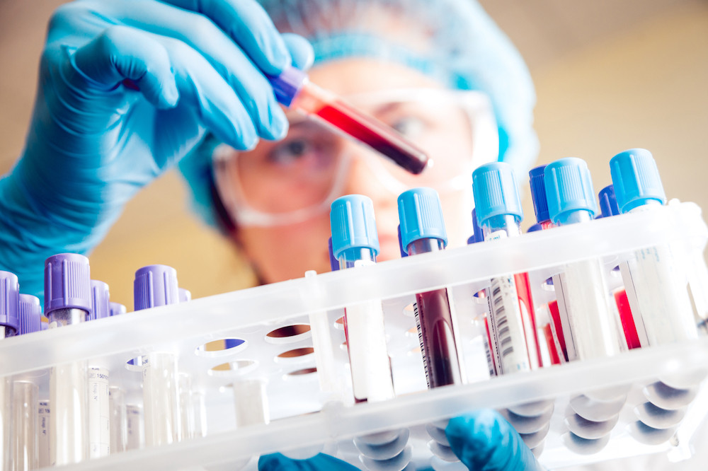 L’entreprise strasbourgeoise Biosynex aurait mis au point un nouveau test sérologique à partir d’une simple goutte de sang. (Photo: Shutterstock)