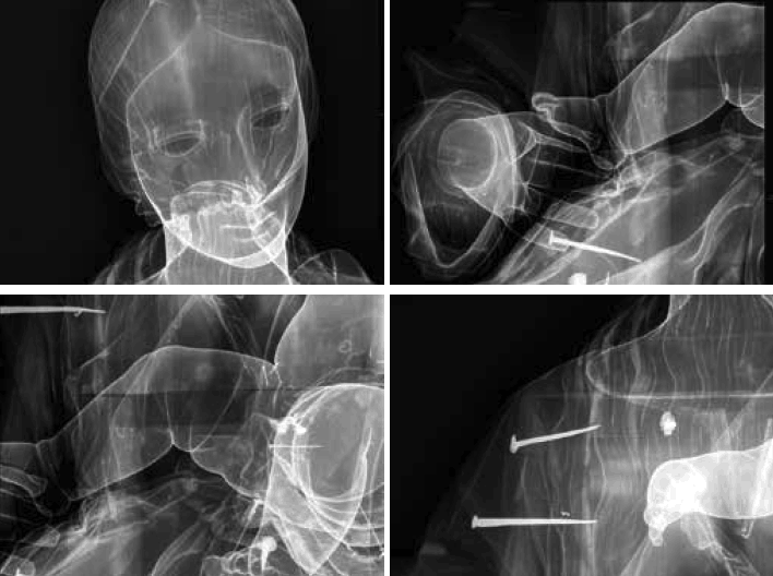 Exemples de radiographies réalisées sur une des sculptures. (Photo: CHdN)