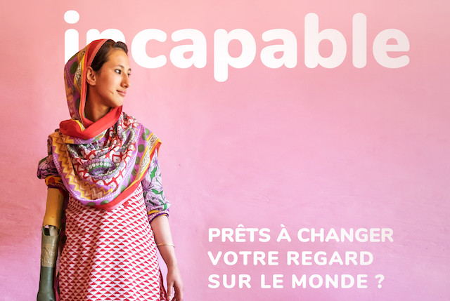 Shaista 17 ans a perdu sa jambe gauche et son bras droit suite a un accident avec un camion alors qu'elle avait 4 ans.   (Photo : Lucas Veuve)