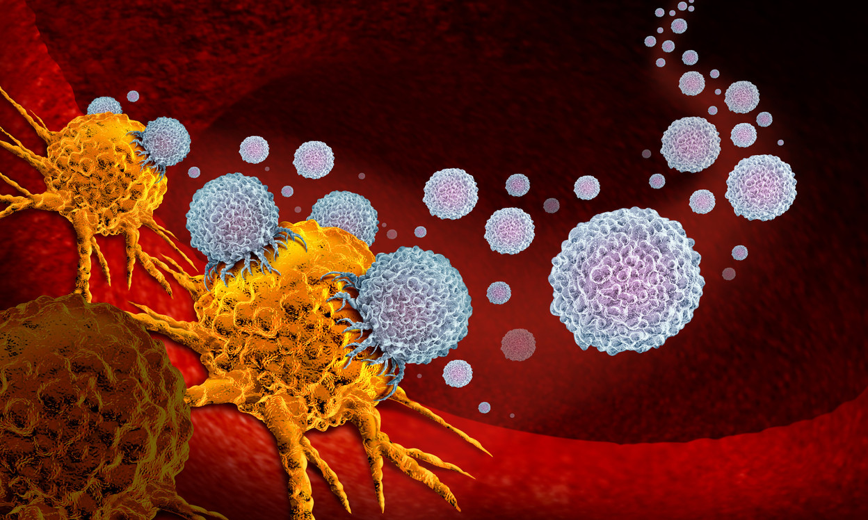 Cancer immunotherapy uses a patient’s own immune system to attack cancer cells, but remains a less successful treatment for now.  Copyright (c) 2019 Lightspring/Shutterstock.  No use without permission.