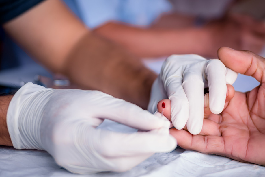 Rapid testings usually take less than 5 minutes to detect an HIV infection. While numbers of infections are stable in Luxembourg, testing has gone down. Copyright (c) 2018 Jes2u.photo/Shutterstock. No use without permission.
