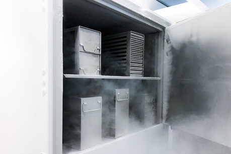 Congélateurs high tech à ultra basse température -86°C. Photo: B Medical Systems
