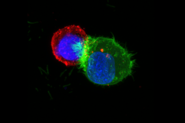 Les chercheurs du LIH ont découvert que certaines cellules cancéreuses étaient capables de déployer un bouclier moléculaire qui les protège des cellules immunitaires qui cherchent à les éliminer. (Photo: LIH)