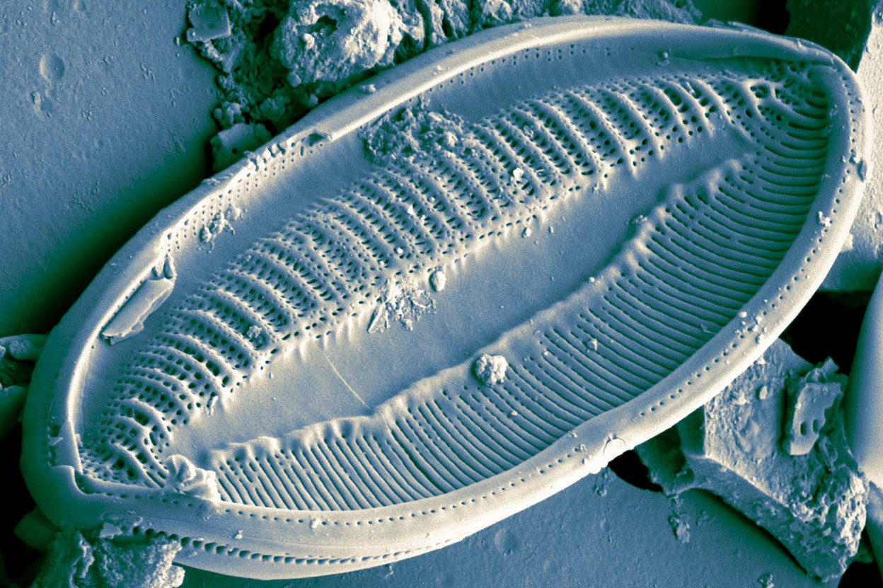 Soil health is crucial in combating climate change and increasing food production, but it is hard to measure and harder to improve. Pictured: a photo of a diatom, one metric of soil health, taken and colourised by LIST researcher Dr Carlos Wetzel. Photo: Carlos Wetzel