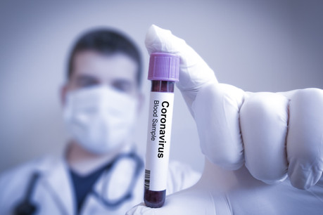 La pandémie de coronavirus a fait 33.000 victimes dans le monde depuis son début. (Photo: Shutterstock)