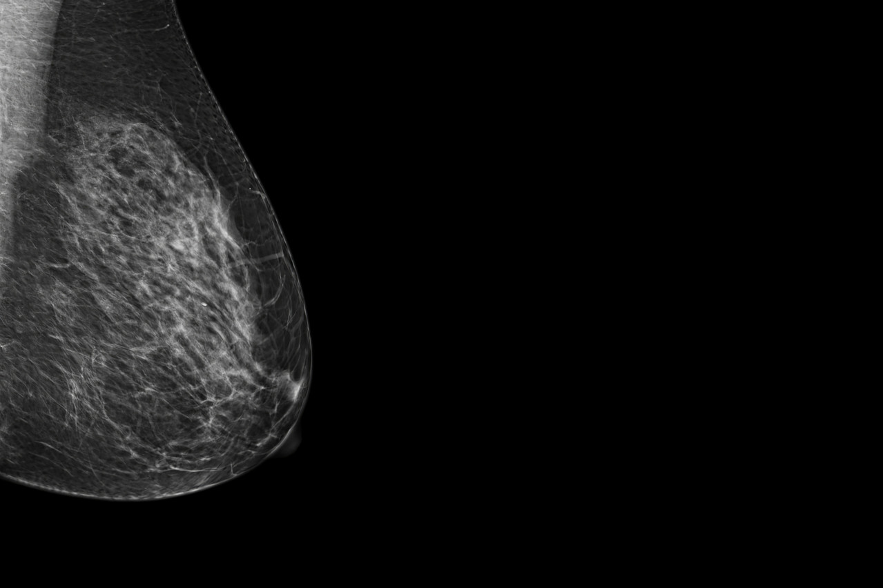 L’intelligence artificielle, «nourrie» avec des mammographies, pourrait aider les radiologues à rendre leur pronostic plus juste. (Photo: Shutterstock)
