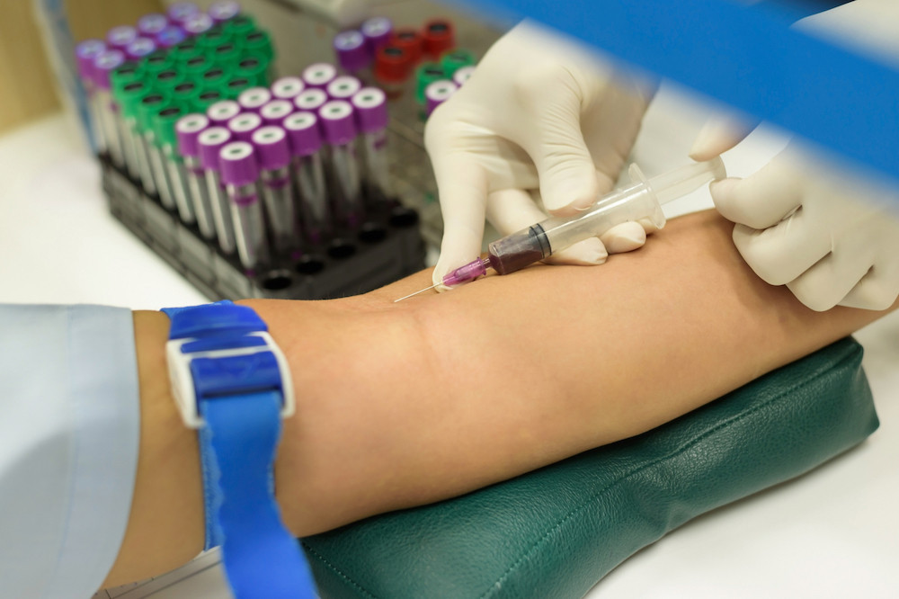 Six centres de prélèvement sont prévus pour les prises de sang dans le cadre du large scale testing, avec une capacité allant jusqu’à 1.000 tests sérologiques par semaine. (Photo: Shutterstock)