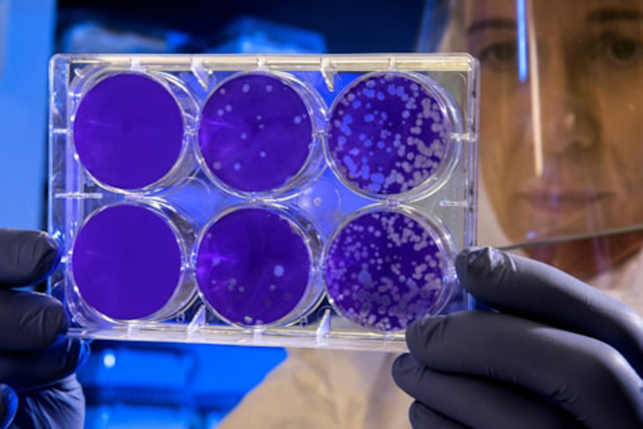 En modifiant certains acides aminés des protéines messagères, on peut reprogrammer la trajectoire des cellules immunitaires.  (Photo: LIH)